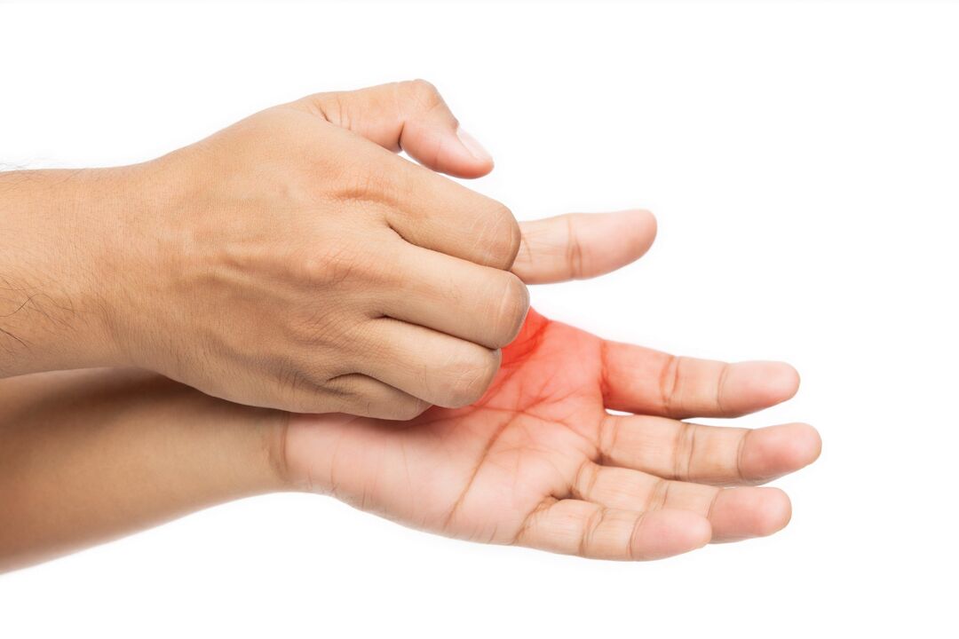 Jucken mat Pilz a senger Behandlung mam Deyxil Crème