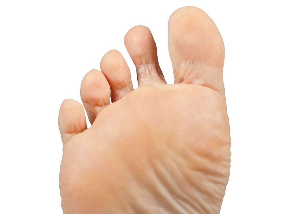 Länger-gutt-a-Pair-a-hektesch-crem-Demyxil